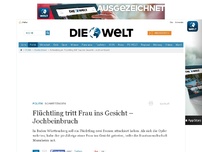 Bild zum Artikel: Schwetzingen: Flüchtling tritt Frau ins Gesicht – Jochbeinbruch