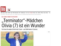 Bild zum Artikel: „Terminator“-Mädchen - Olivia spürt keine Schmerzen