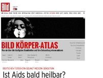 Bild zum Artikel: Medizin-Sensation - Ist Aids bald heilbar?