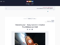 Bild zum Artikel: 'Glückshaube' - Baby kommt in intakter Fruchtblase zur Welt