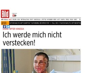 Bild zum Artikel: Säure-Opfer Vanessa - Ich werde mich nicht verstecken!