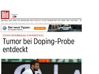 Bild zum Artikel: Schock für Bundesliga-Star - Tumor bei Doping-Kontrolle entdeckt