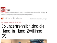 Bild zum Artikel: Hand in Hand geboren - So unzertrennlich sind die Zwillingsmädchen heute