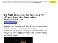 Bild zum Artikel: Die Ärzte dachten, es sei Ausschlag von giftigem Efeu, aber Tage später bemerktes sie DAS.