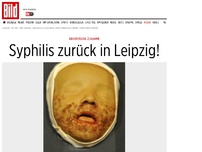 Bild zum Artikel: Dramatische Zunahme - Syphilis zurück in Leipzig!