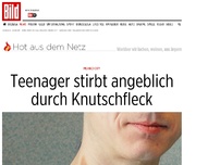 Bild zum Artikel: Mexiko City - Teenager stirbt angeblich durch Knutschfleck