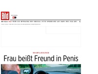 Bild zum Artikel: Reh-Unfall bei Blowjob - Frau beißt Freund in Penis