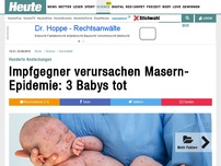Bild zum Artikel: Hunderte Ansteckungen: Impfgegner verursachen Masern-Epidemie: 3 Babys tot