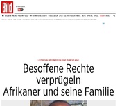 Bild zum Artikel: Kind (5) verletzt - Besoffene Rechte verprügeln Afrikaner-Familie