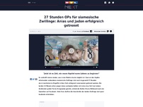 Bild zum Artikel: 27 Stunden OPs für siamesische Zwillinge: Anias und Jadon erfolgreich getrennt