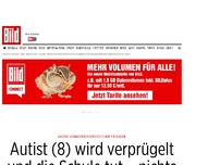 Bild zum Artikel: Schwester postet Foto - Autist (8) wird verprügelt und die Schule tut – nichts