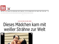 Bild zum Artikel: Genau wie seine Mama - Baby kommt mit weißer Haarsträhne zur Welt