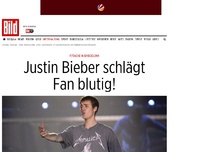 Bild zum Artikel: Attacke in Barcelona - Justin Bieber schlägt Fan blutig!