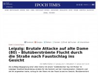 Bild zum Artikel: Leipzig: Brutale Attacke auf alte Dame (80) – Blutüberströmte Flucht durch die Straße nach Faustschlag ins Gesicht