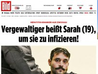 Bild zum Artikel: Hepatitis-Kranker - Vergewaltiger beißt Sarah, um sie zu infizieren!