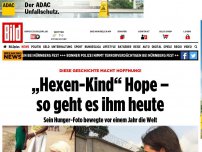 Bild zum Artikel: Das macht Hoffnung! - „Hexen-Kind“ Hope – so geht es ihm heute