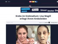 Bild zum Artikel: Krebs im Endstadium: Lisa Magill erliegt ihrem Krebsleiden