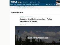 Bild zum Artikel: Berliner Mauerpark: Joggerin den Kiefer gebrochen - Polizei veröffentlicht Fotos
