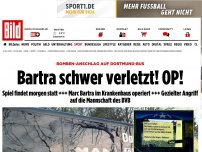 Bild zum Artikel: Spielabsage droht - Explosion vor dem Dortmund-Bus