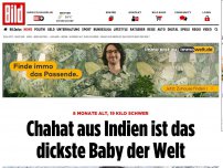 Bild zum Artikel: 8 Monate, 19 Kilo - Chahat ist das wohl dickste Baby der Welt