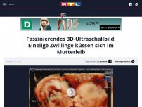 Bild zum Artikel: Faszinierendes 3D-Ultraschallbild: Eineiige Zwillinge küssen sich im Mutterleib