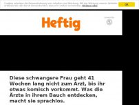 Bild zum Artikel: Diese schwangere Frau geht 41 Wochen lang nicht zum Arzt, bis ihr etwas komisch vorkommt. Was die Ärzte in ihrem Bauch entdecken, macht sie sprachlos.