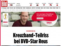 Bild zum Artikel: Diagnose da - Kreuzband-Teilriss bei BVB-Star Reus