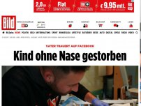 Bild zum Artikel: Vater trauert auf Facebook - Kind ohne Nase gestorben