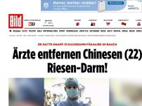 Bild zum Artikel: 13 kg Fäkalien im Bauch - Ärzte entfernen Chinesen (22) Riesen-Darm!