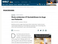 Bild zum Artikel: Sehbeschwerden: Ärzte entdecken 27 Kontaktlinsen im Auge von Patientin