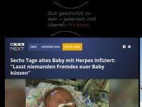 Bild zum Artikel: Sechs Tage altes Baby mit Herpes infiziert: 'Lasst niemanden Fremdes euer Baby küssen'