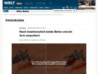 Bild zum Artikel: Gebäudereinigerin aus Köln: Nach Insektenstich beide Beine und ein Arm amputiert