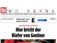 Bild zum Artikel: Blut-Drama um VfB-Kapitän - Hier bricht der Kiefer von Gentner