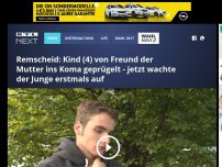 Bild zum Artikel: Remscheid: Kind (4) von Freund der Mutter ins Koma geprügelt - jetzt wachte der Junge erstmals auf.