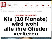 Bild zum Artikel: Schwere Meningitis - Kia (10 Monate) wird wohl alle ihre Glieder verlieren