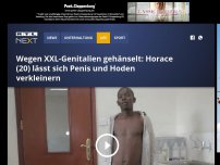 Bild zum Artikel: Wegen XXL-Genitalien gehänselt: Horace (20) lässt sich Penis und Hoden verkleinern