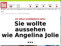 Bild zum Artikel: Zu viele Schönheits-OPs! - Sie wollte aussehen wie Angelina Jolie …