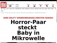 Bild zum Artikel: Schwere Verbrennungen - Horror-Paar steckt Baby in Mikrowelle