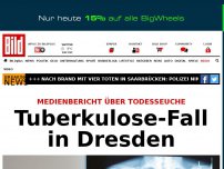 Bild zum Artikel: Medienbericht - Tuberkulose in Dresden ausgebrochen