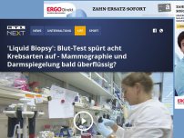 Bild zum Artikel: 'Liquid Biopsy': Blut-Test spürt acht Krebsarten auf - Mammographie und Darmspiegelung bald überflüssig?