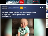 Bild zum Artikel: Er setzte sich gegen 140.000 Babys durch: Junge mit Down-Syndrom ist jetzt Werbestar