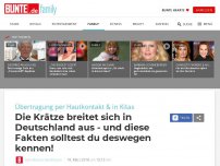 Bild zum Artikel: Die Krätze breitet sich in Deutschland aus: Das solltest du jetzt wissen!