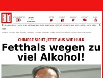 Bild zum Artikel: Chinese sieht aus wie Hulk - Fetthals wegen zu viel Alkohol!