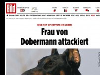 Bild zum Artikel: Lebensgefahr! - Frau von Dobermann attackiert