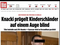 Bild zum Artikel: Prozess in berlin - Knacki verprügelt Kinderschänder – Opfer auf einem Auge blind
