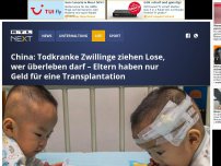 Bild zum Artikel: China: Todkranke Zwillinge ziehen Lose, wer überleben darf – Eltern haben nur Geld für eine Transplantation