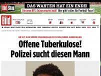 Bild zum Artikel: Aus Klinik abgehauen - Offene Tuberkulose! Polizei sucht diesen Mann