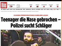 Bild zum Artikel: in Berliner U-Bahn - Teenager erlitt Nasenbruch – Schläger gesucht!