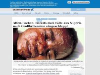 Bild zum Artikel: Affen-Pocken: Bereits zwei Fälle aus Nigeria nach Großbritannien eingeschleppt