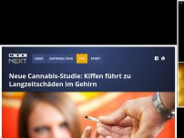 Bild zum Artikel: Neue Cannabis-Studie: Kiffen führt zu Langzeitschäden im Gehirn